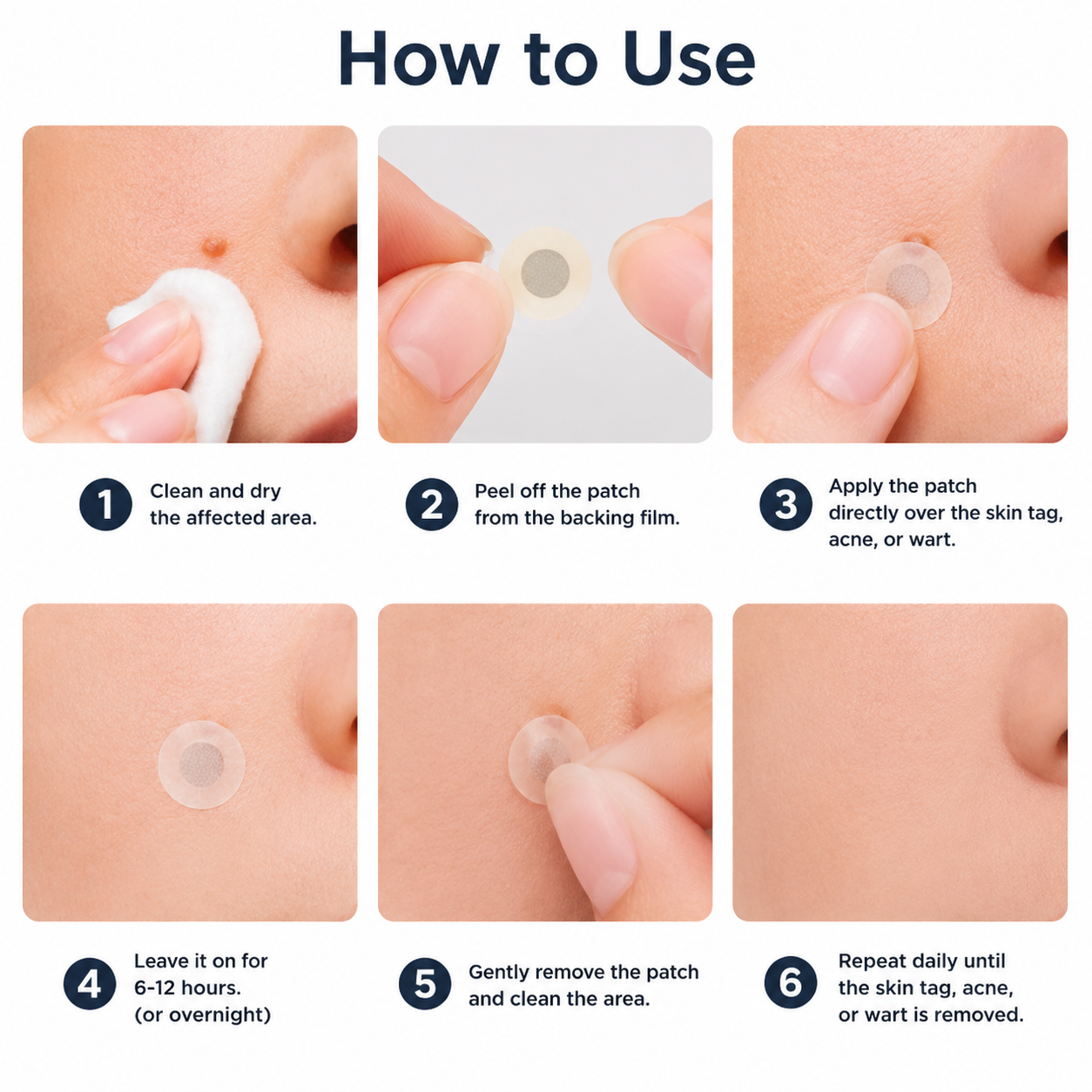 2-in-1 Microneedle & Hydrocolloid Patch🍀