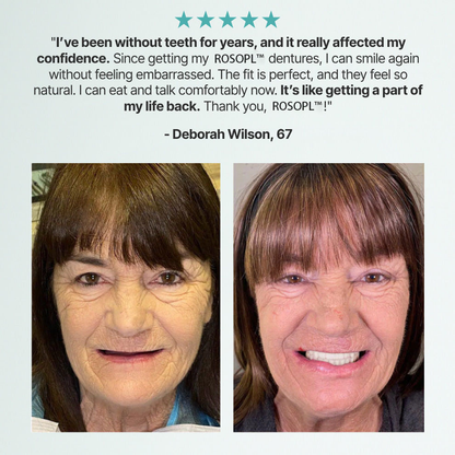 🌎Ends Today: 70% OFF! - Custom-Fit Full Functional Dentures Make you more confident✨