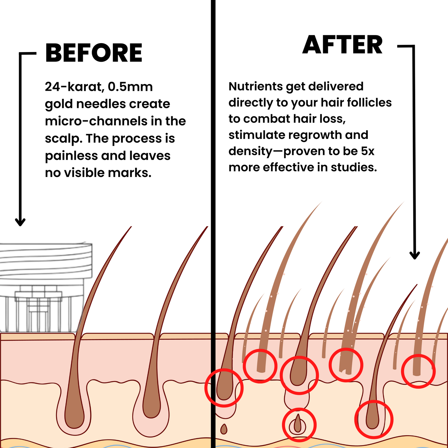 ALPHA™ Hair Regrowth System