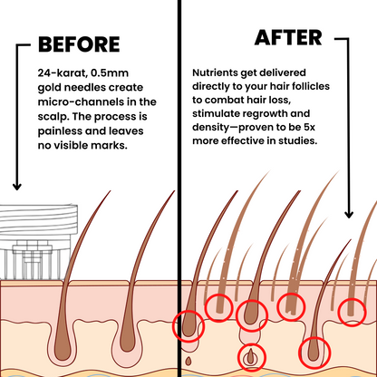 ALPHA™ Hair Regrowth System